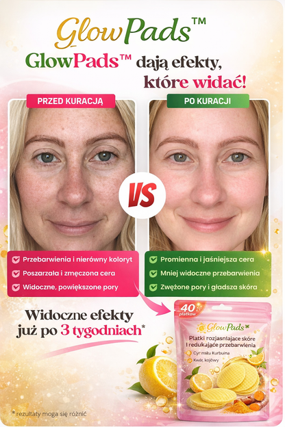 GlowPads™ — Płatki rozjaśniające skórę i redukujące przebarwienia