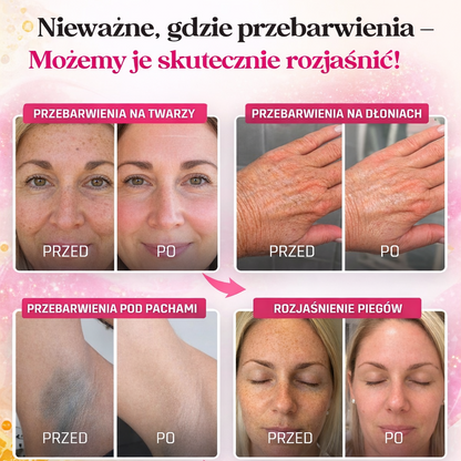 GlowPads™ — Płatki rozjaśniające skórę i redukujące przebarwienia